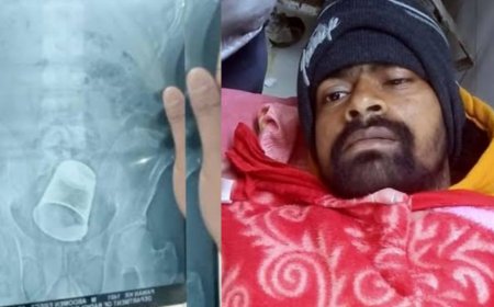 Bihar News: ससुराल वालों ने दामाद के साथ की मारपीट, प्राइवेट पार्ट में डाला स्टील का ग्लास